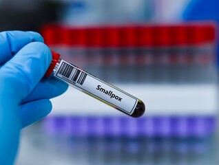 Blood sample tube for smallpox virus test analysis.