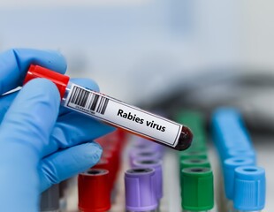 Blood sample tube for rabies virus test analysis.