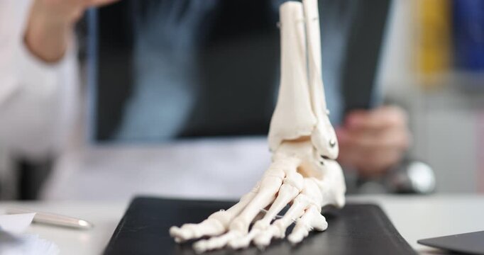 Orthopedic doctor holds foot X-ray behind ankle skeleton model. Specialist studies feet bones alignment on image planning treatment for patient