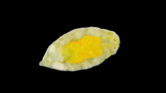 Worm Dinophilus taeniatus under a microscope, family Dinophilidae. Sample found in White Sea