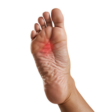 Foot Pain on the Sole of a Person's Foot