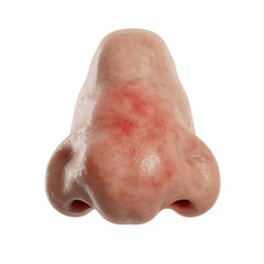 Human nose with red irritated skin with Transparent Background
