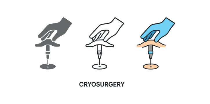 cryosurgery gloved hand gently stretching skin for precise freezing