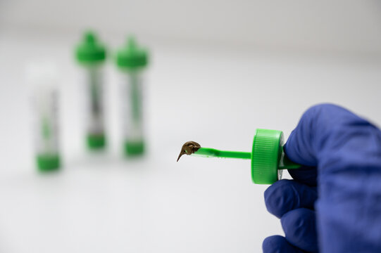 Hand in glove holding stool sample for parasite analysis