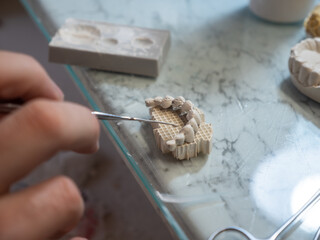 Dental technician modeling dental prosthesis mold in lab using hand tools. Dental restoration, prosthodontics, manual precision work.
