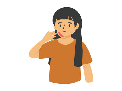 Mumps Disease or Parotitis in Cheek
