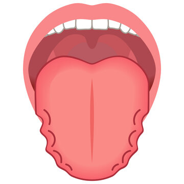 ふちがデコボコしている舌　舌でわかる健康状態　舌診　舌の健康