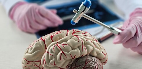 A neurologist, holding a neurological hammer, conducts examinations of the brain.