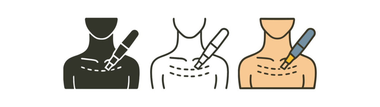 microneedling neck and d&eacute;collet&eacute; outline treated with pen strokes