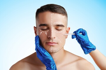 Facial line marking during cosmetic procedure at clinic for beauty enhancement