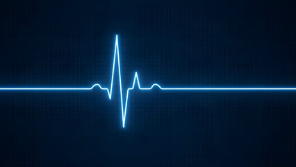 Heartbeat monitor showing normal heart activity