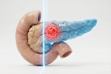 Fototapeta premium AI-Driven Pancreatic Tumor Segmentation: Biological to Digital Twin Transformation with Precise Measurement 