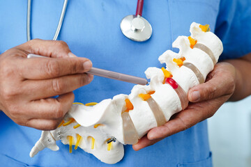 Asian doctor holding spinal nerve and bone model, Lumbar spine displaced herniated disc fragment for treatment medical in the orthopedic department.