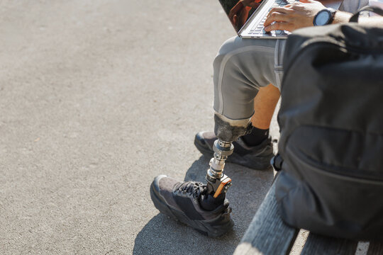 Man with a prosthetic leg using wireless technology devices while sitting outdoors on a bench, working on a laptop and talking on a smartphone.