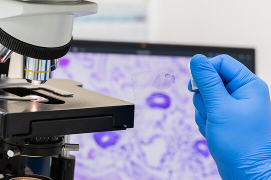 Scientist wear blue glove holding glasses slide human tissue, microscope and out of focus computer monitor show glandular image.Medical patholology and cytology laboratory technology concept.