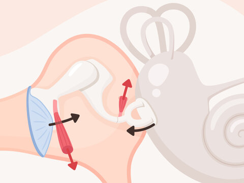 耳小骨筋反射のイラスト