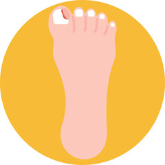 Represents nail problems commonly associated with diabetes, such as thickened, brittle, or discolored toenails that require proper care.