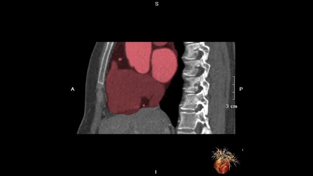 Medical video showing multiplanar reconstruction (MPR) CT scan with sagittal, coronal, and axial views, illustrating detailed human head anatomy for radiology, diagnostic imaging, and medical educatio