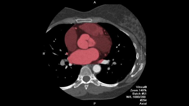 Medical video showing multiplanar reconstruction (MPR) CT scan with sagittal, coronal, and axial views, illustrating detailed human head anatomy for radiology, diagnostic imaging, and medical educatio