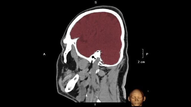 3D sagittal CT scan of the human head showing detailed brain, skull, facial bones, and cervical spine anatomy, used for medical education, diagnostics, and healthcare visualization