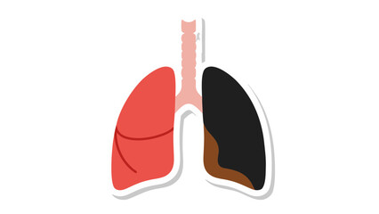Diseased Lung vs Healthy Lung Illustration - Smoking Impact