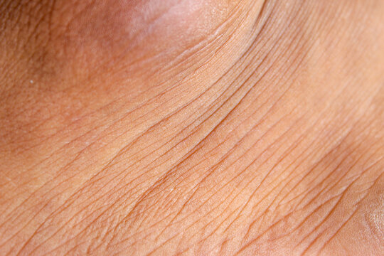 Wrinkled skin texture on men's legs