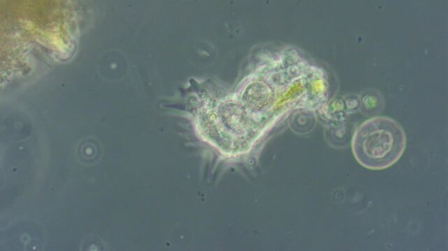 An amoeba cell moves slowly in water using pseudopodia, as seen under a microscope.