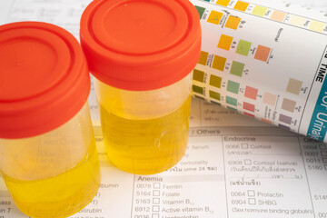 Urinalysis, urine cup with reagent strip pH paper test and comparison chart in laboratory.