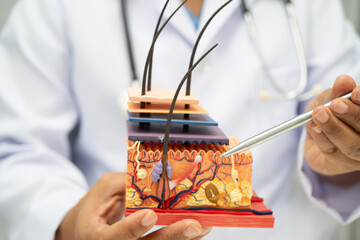 Asian dermatologist doctor holding skin structure model anatomy for treatment in hospital, hair transplant.