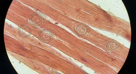 Macro photo of Trichinella spiralis parasites between meat fibers, seen under a microscope