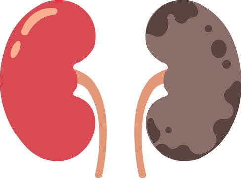 Healthy and Diseased Kidneys Comparison