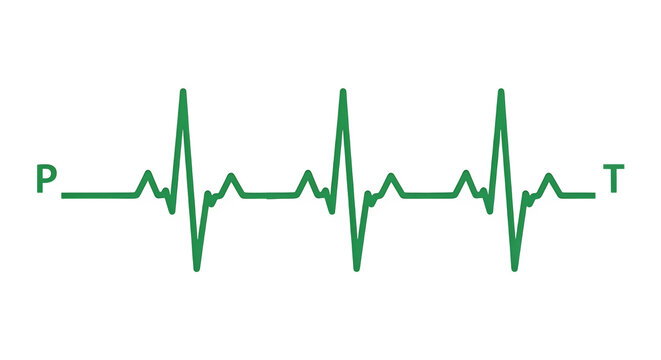 Ecg heartbeat line graph showing p qrs t waves isolated on transparent background