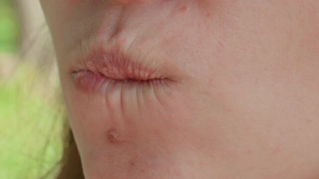 female outdoors with cracked lips, caucasian woman engaged in outdoor activity showing dry lips, caucasian woman participating in outdoor event exhibiting severely chapped lips from exposure