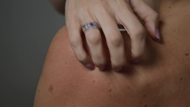 Rear view close up shot of unrecognizable woman scratching itchy skin on bare shoulders on minimal grey background