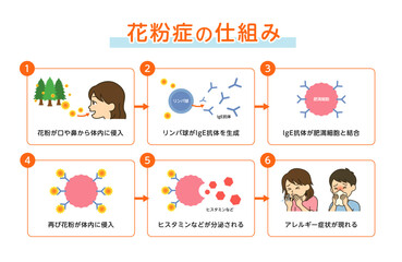 花粉症の仕組みメカニズムを解説したイラスト図解