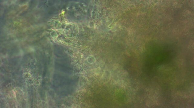The rotifer Adineta vaga has taken up residence among organic remains and filters the water, capturing bacteria; its filtering gills move, filtering the water.