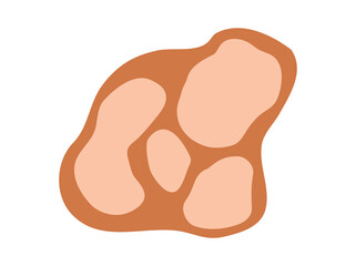 Hand Drawn Vitiligo Pigment Loss
