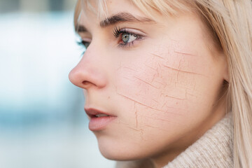 Woman with cracked on face as cosmetic and dehydration effect concept.