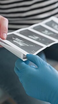 closeup gloved hands examining ultrasound prints sonographer points at fetal sonogram strip while white patient in striped shirt watches, blue latex gloves handling film, clinical setting, focused