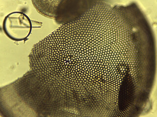 Microscopic Collection of Various Diatom Silica Shells and Biological Specimen Sli © Mohammed