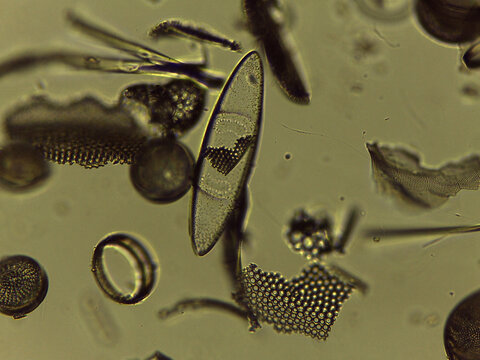 Microscopic Collection of Various Diatom Silica Shells and Biological Specimen Sli