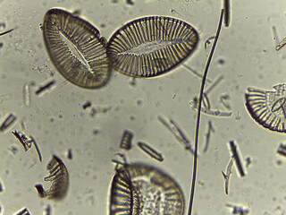 High Resolution Microscopic Study of Ornate Diatom Silica Frustules and Aquatic Microorgani © Mohammed