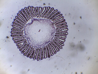 Microscopic Anatomy of Coprinus Mushroom Basidia Spores and Fungal Reproductive Structu