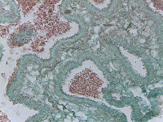 Microscopic Examination of Claviceps Purpurea Conidia and Fungal Reproductive Structu © Mohammed