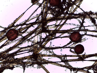 Microscopic Visualization of Rhizopus Hyphae and Zygospore Production for Mycological Resea © Mohammed