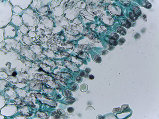 Microscopic Visualization of Cystopus Candidus Albugo White Rust Fungal © Mohammed