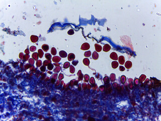 Microscopic Visualization of Puccinia Graminis Wheat Stem Rust Life C © Mohammed