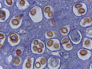 Microscopic Examination of Tuber Rufum Truffle Fruiting Body and Ascospore Morph © Mohammed
