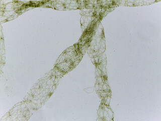 Microscopic Visualization of Oedogonium Nanandrisch Algae and Specialized Reproductive Ana © Mohammed