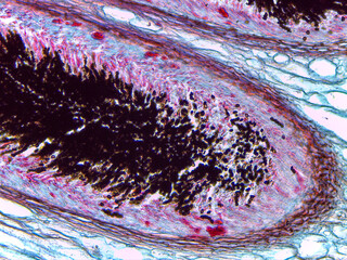 Microscopic Detailed Visualization of Xylaria Stroma and Fungal Reproductive Structures Ana © Mohammed